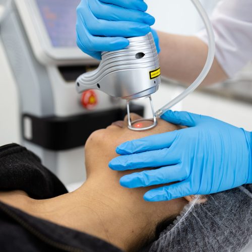 face-skin-care-asian-woman-getting-facial-laser-t-2024-03-01-16-50-32-utc